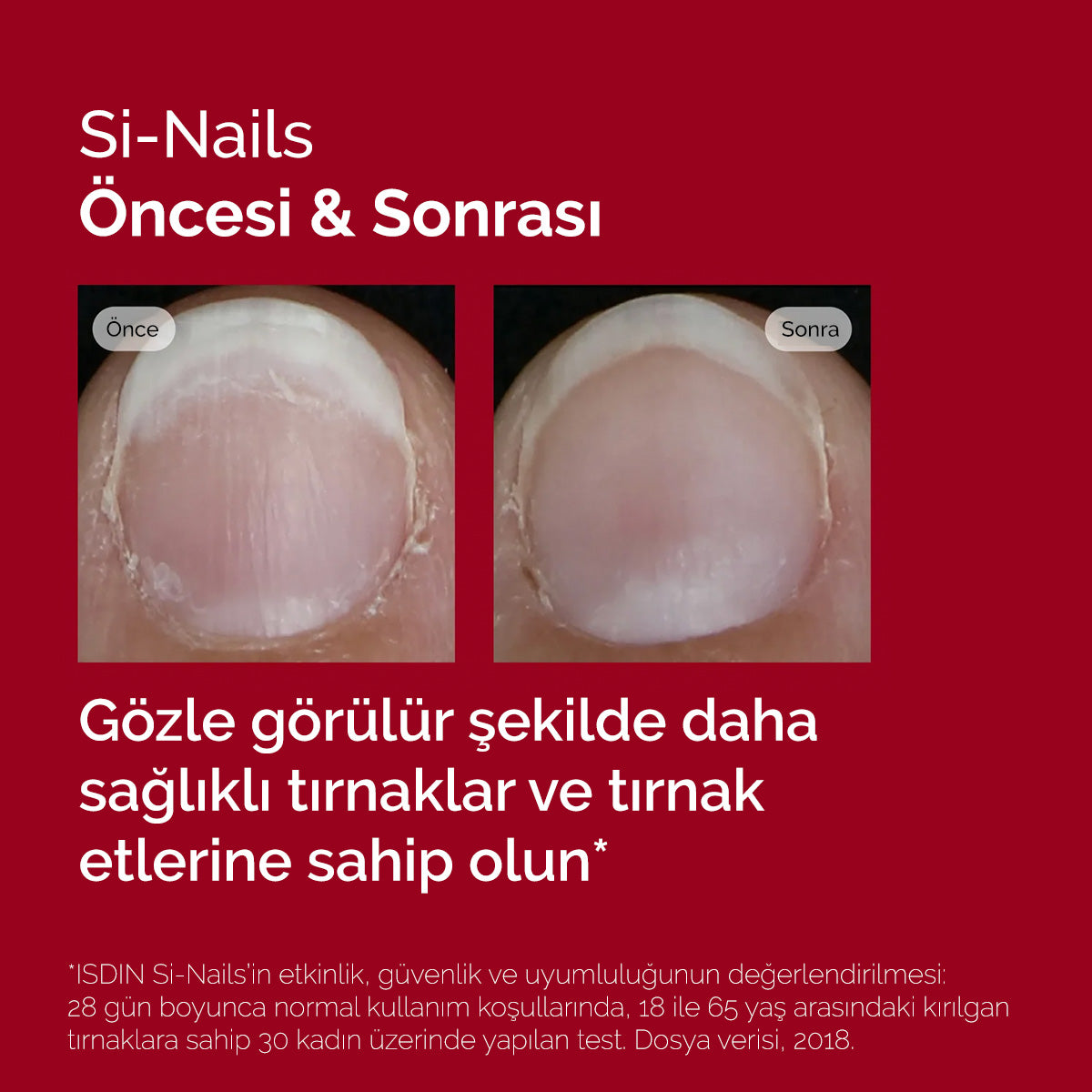 ISDIN Si-Nails Serum 2.5 ml